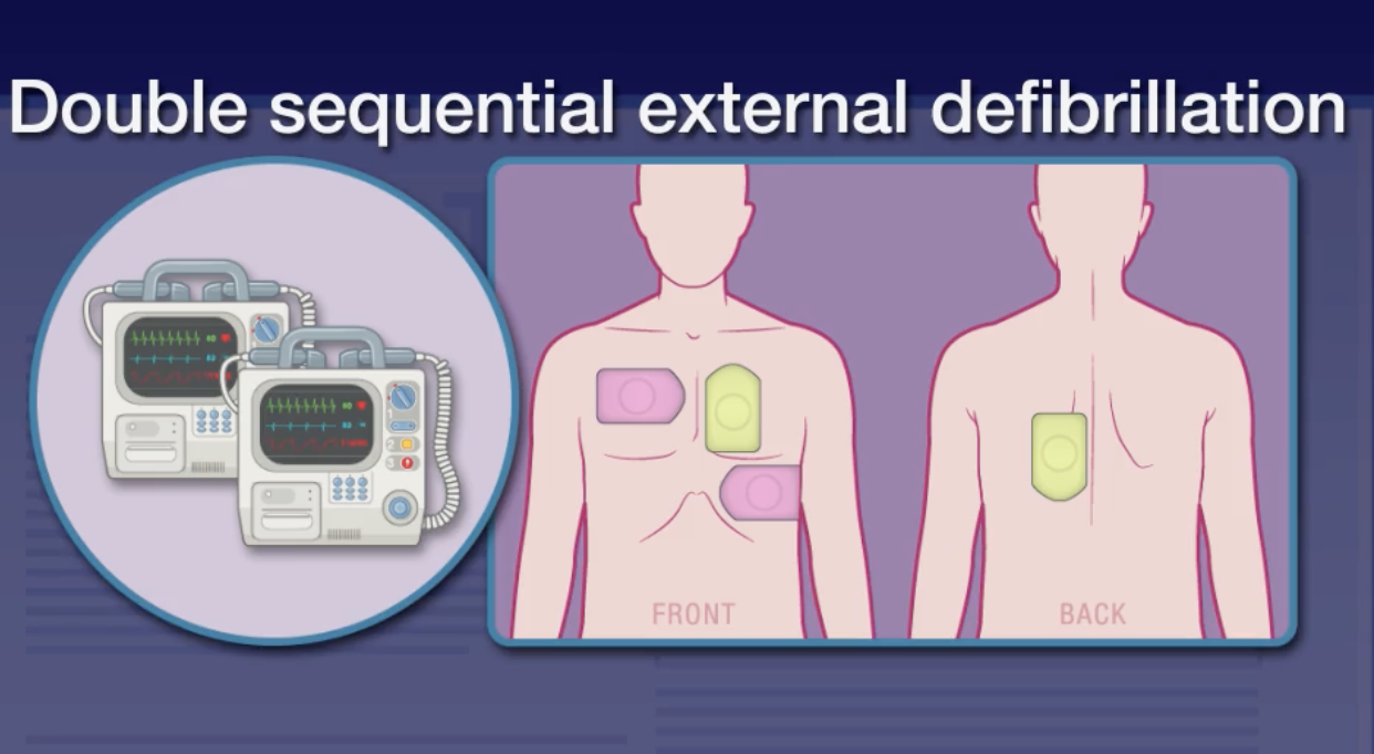 Double sequential external defibrillation