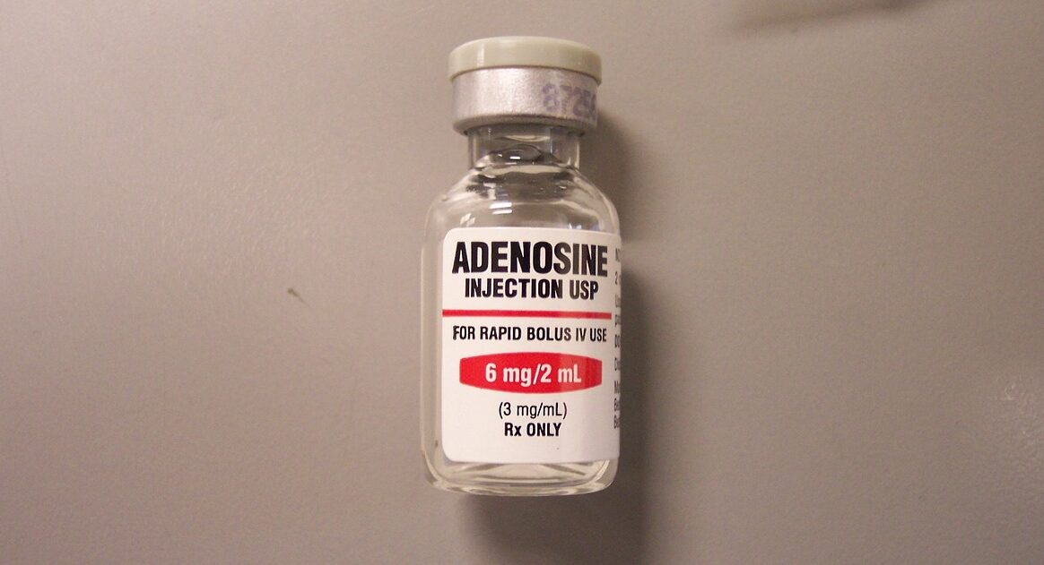 Single-Syringe vs Double-Syringe Adenosine for SVT