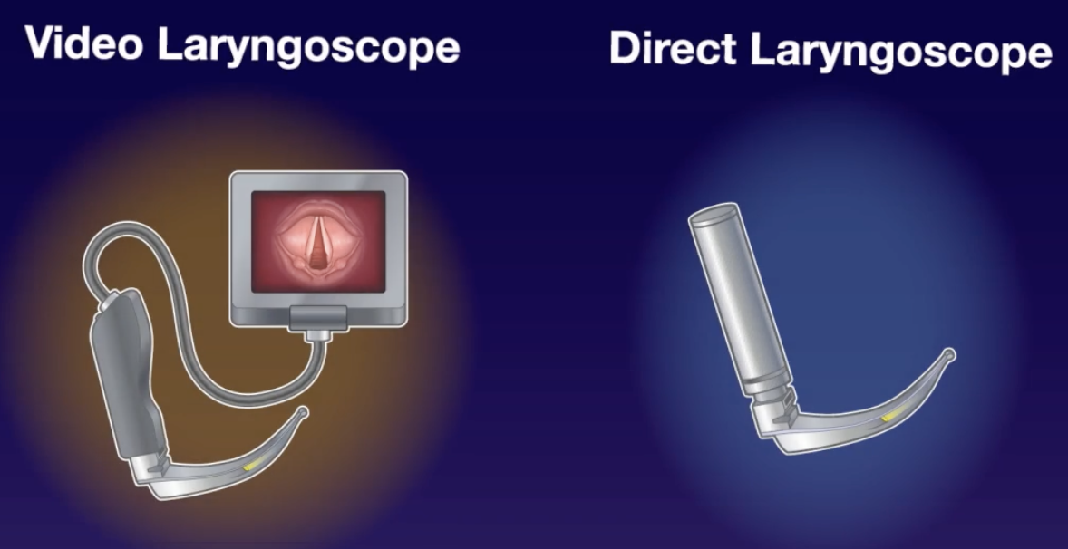 DEVICE: Video vs Direct Laryngoscopy for intubating critically ill adults