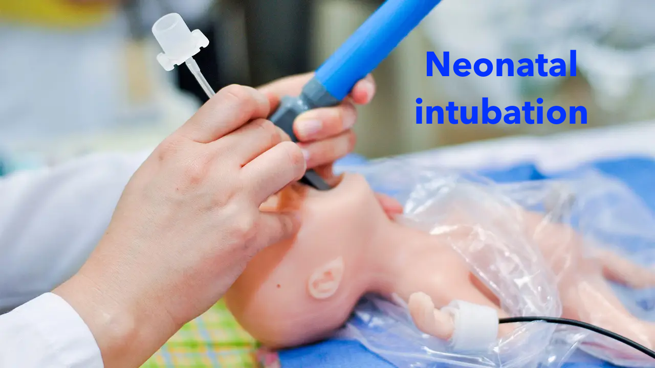 Neonatal intubation